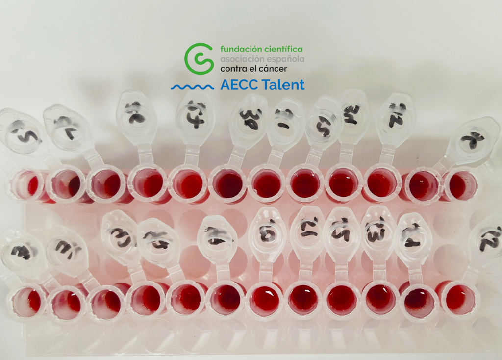 Dissecting the role of the gene HLF (hepatic leukemia factor) in stemness regulation to identify targeted therapeutic options for AML